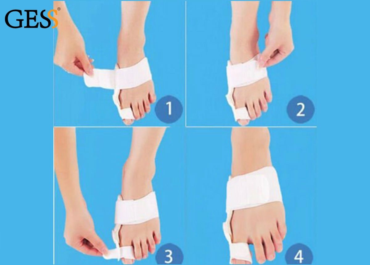 Hallux Valgus Ortoos UNIFLEX GESS suurendatud
